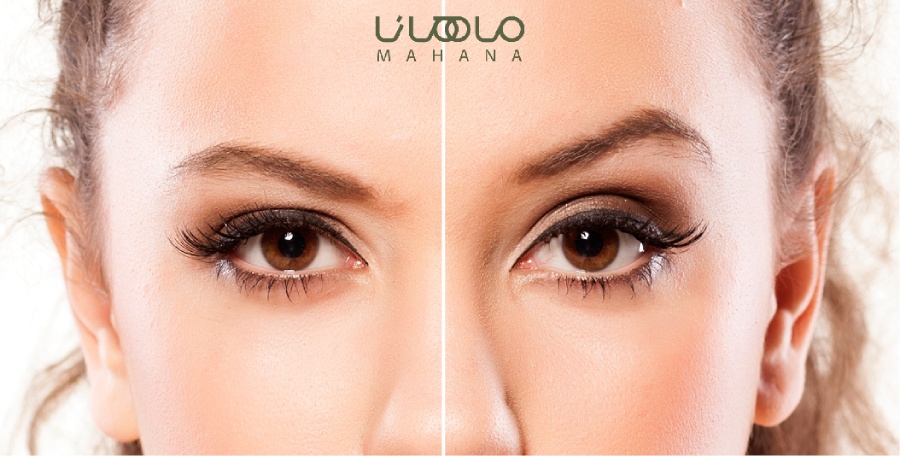 راه های کاهش درد بعد از لیفت ابرو