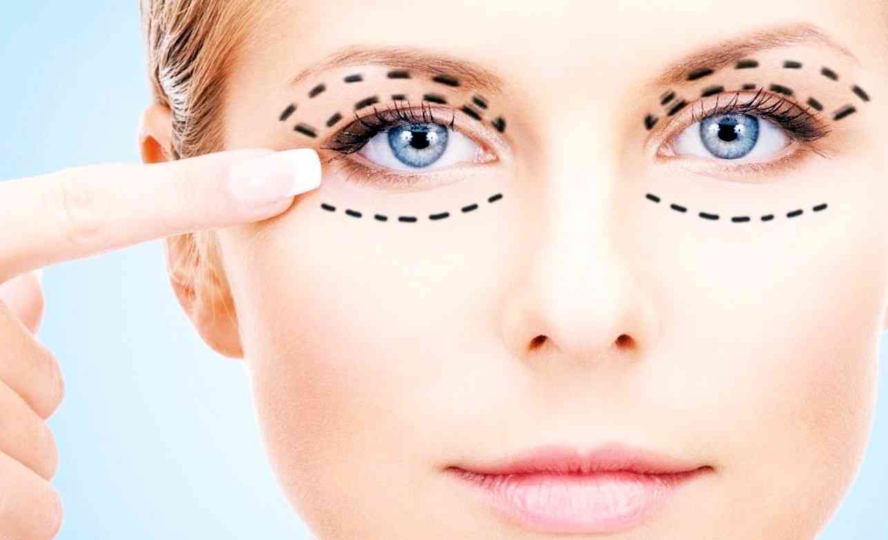 عمل زیبایی پلک دائمی